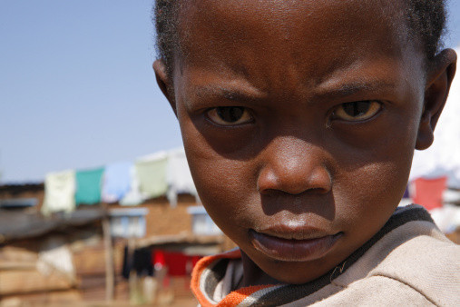 The african kid, who now has to go to school, because of MrBeast: